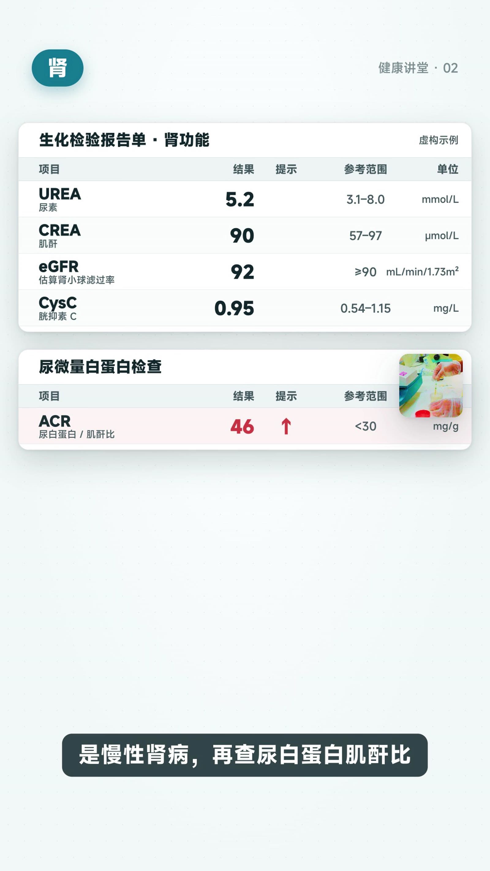 看懂生化报告:肝、肾、血脂、血糖的关键数字与下一步