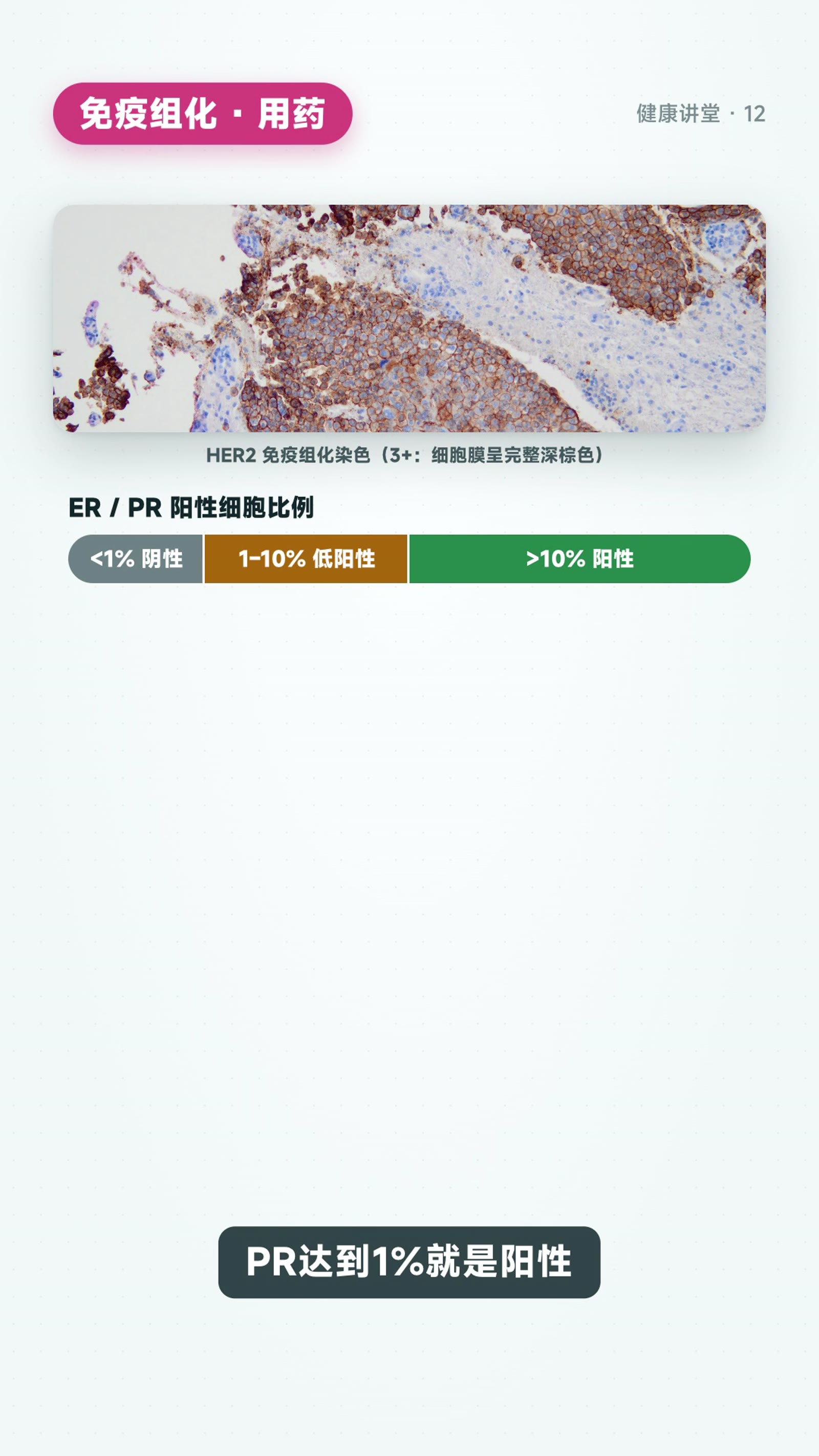 看懂病理报告：从「是什么癌」到「用什么药」