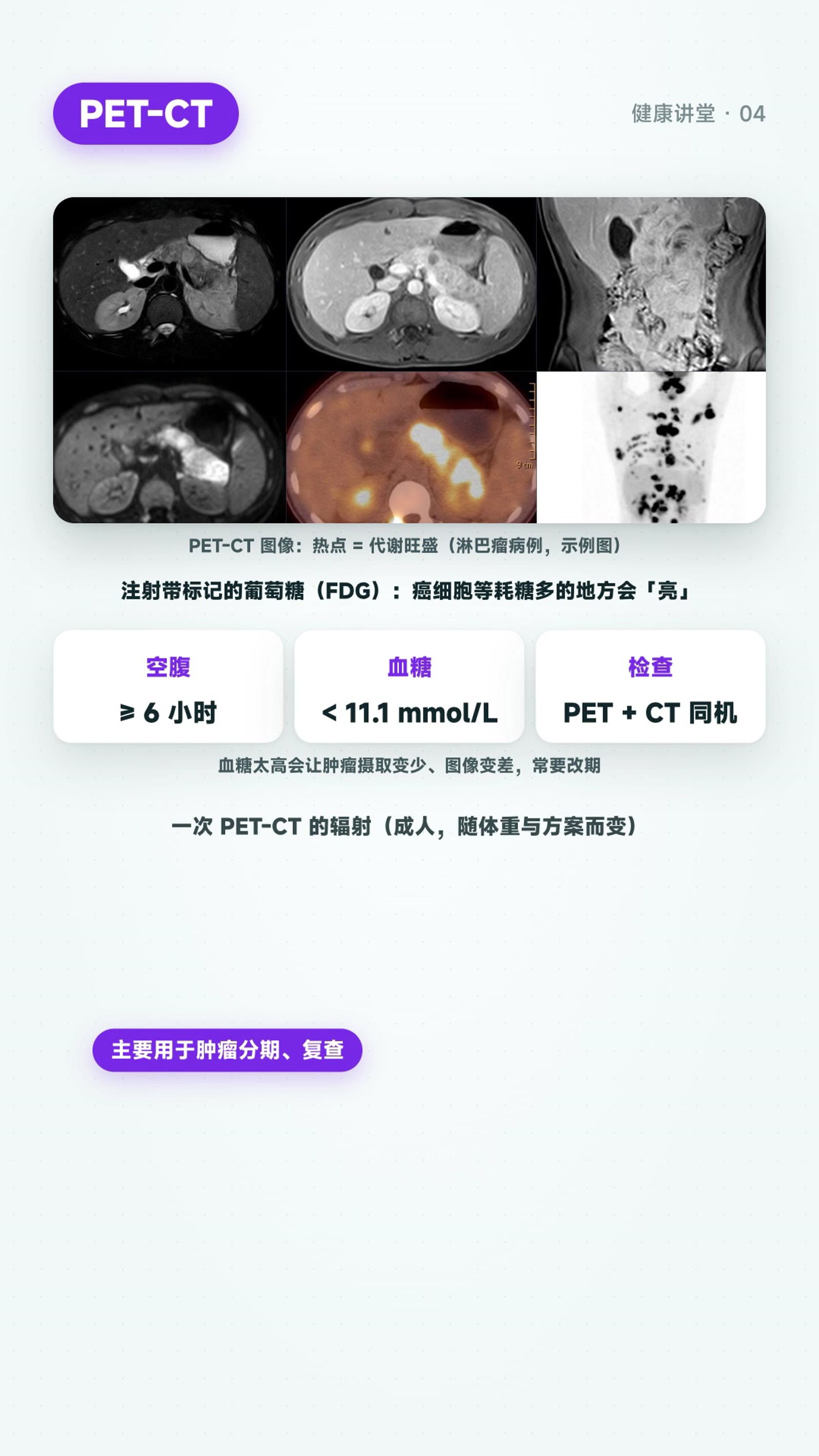 超声、PET-CT、骨密度:三种检查怎么选